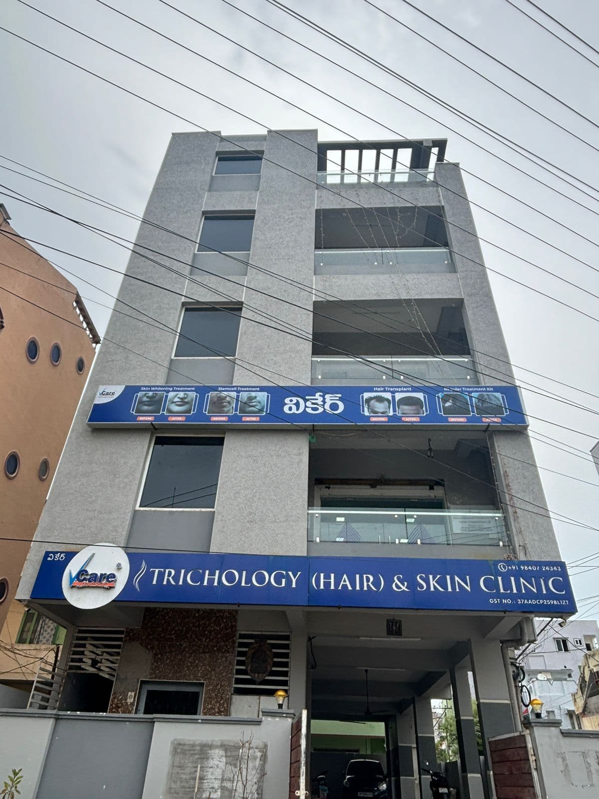 VCare Hair & Skin Clinic - Guntur | Skin Treatment, Hair Treatment, Hair Transplant, Laser Hair Removal, Skin Whitening — photo by VCare Hair & Skin Clinic - Guntur | Skin Treatment, Hair Treatment, Hair Transplant, Laser Hair Removal, Skin Whitening